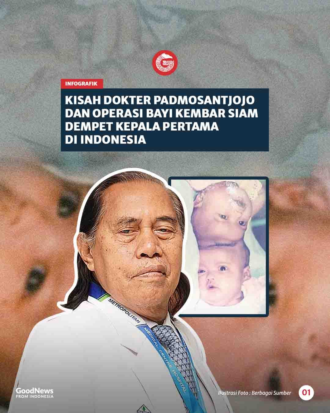 Kisah Dokter Padmosantjojo dan Operasi Bayi Kembar Siam Dempet Kepala Pertama di Indonesia