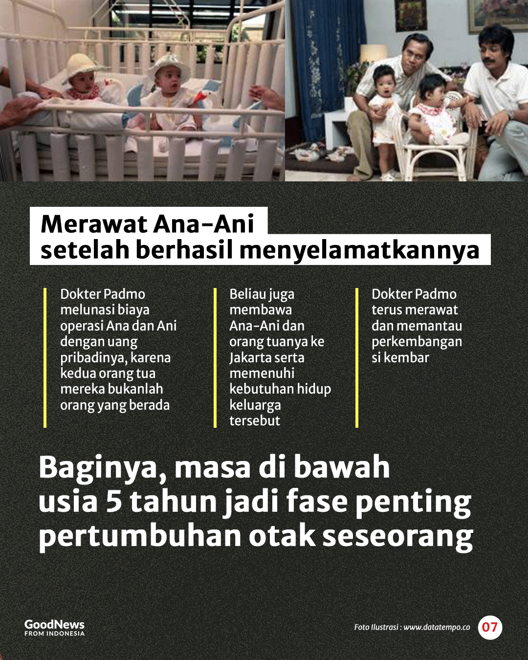 Kisah Dokter Padmosantjojo dan Operasi Bayi Kembar Siam Dempet Kepala Pertama di Indonesia
